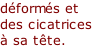 déformés et des cicatrices à sa tête.